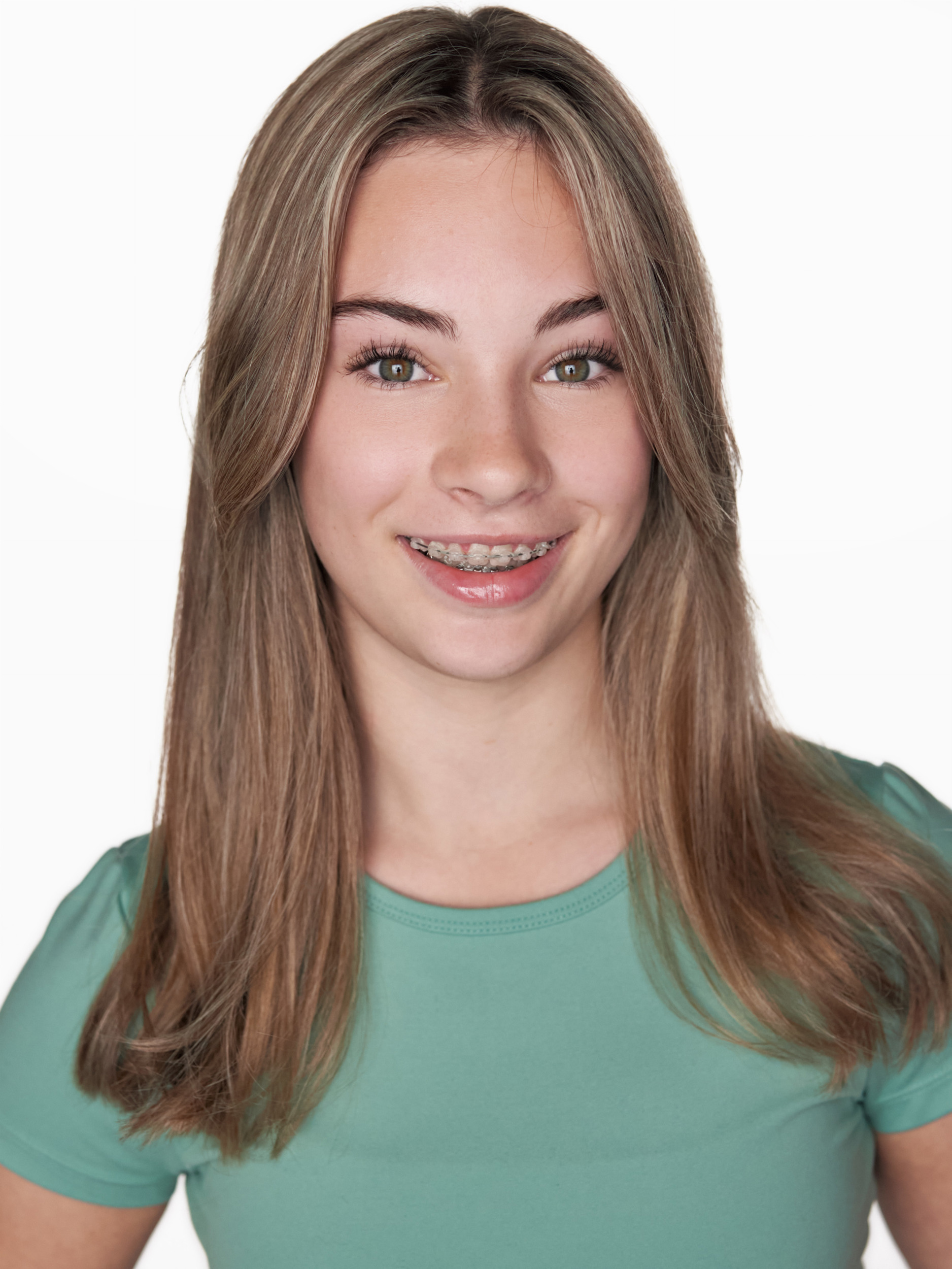 Amya Mollison